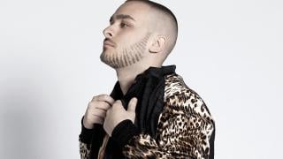 Криско изплаши жестоко в този вид: Пусна се с обилно окосмяване и... ВИДЕО