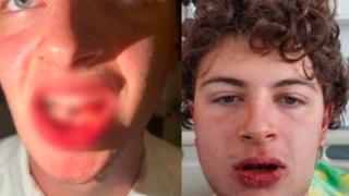 Обрат с бития студент на Джулая, замесен е полицай ВИДЕО