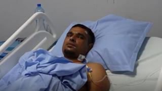 Чудо: Възстановиха отрязания крак на зверски пребития в Раднево 
