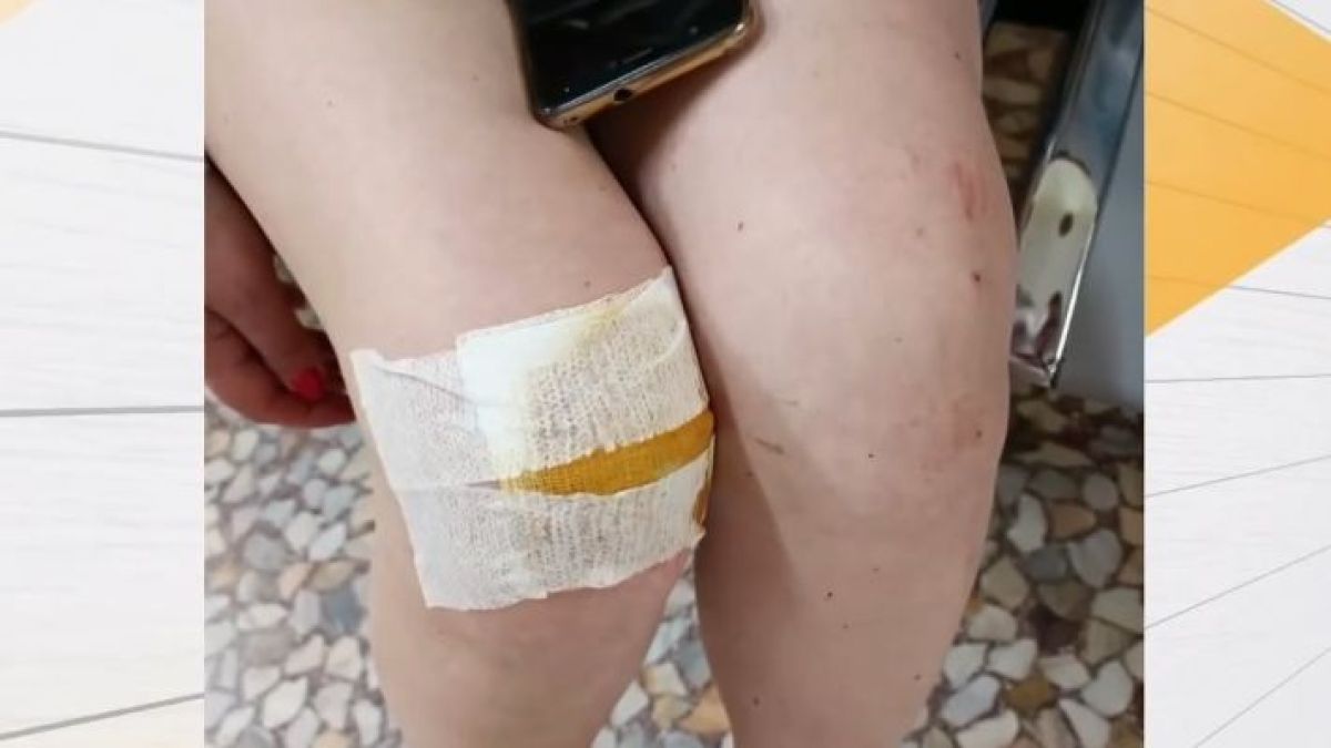 Шофьор блъсна варненка, закара я изпотрошена до болницата и после направи немислимото ВИДЕО