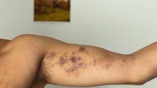 Див екшън в Пловдив: Охранители потрошиха от бой певец, счупиха му зъбите СНИМКИ 18+