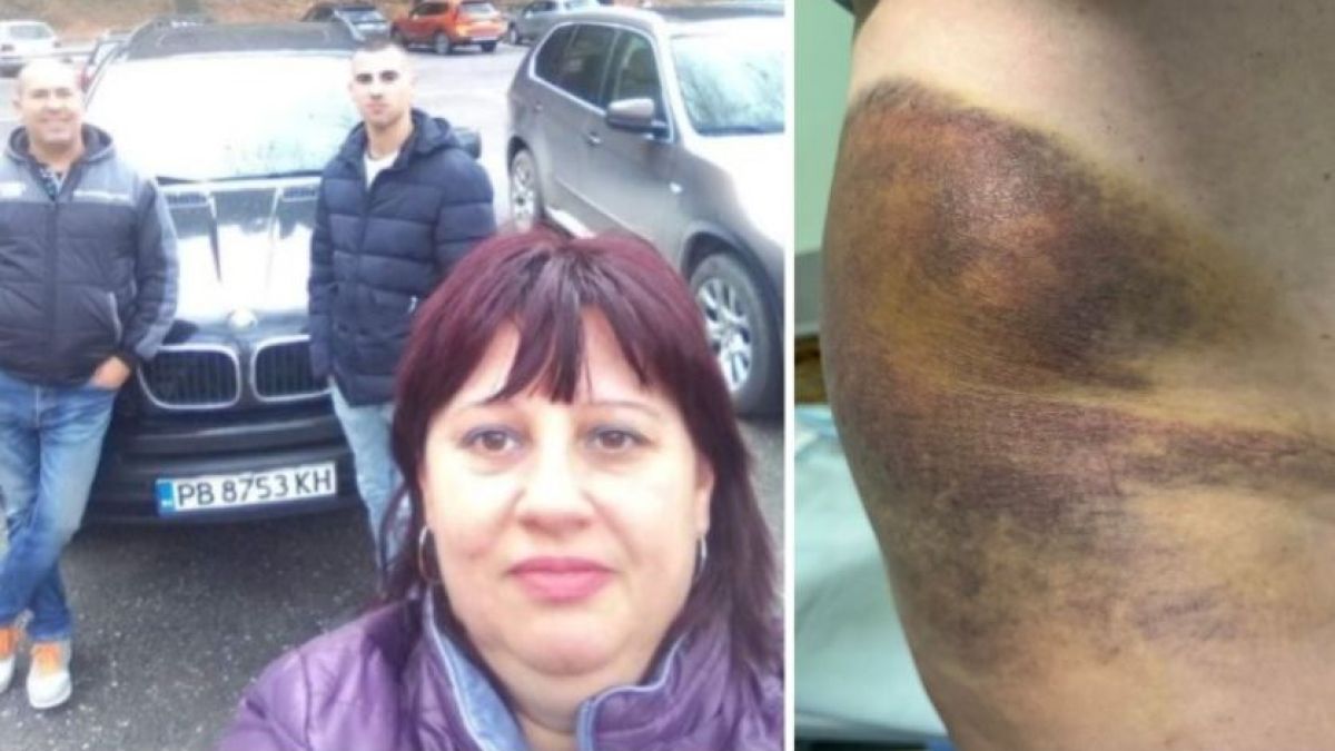 9 месеца след побоя: Тъщата на хванатия на калъп кмет на Цалапица стана бездомен инвалид 