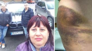 9 месеца след побоя: Тъщата на хванатия на калъп кмет на Цалапица стана бездомен инвалид 
