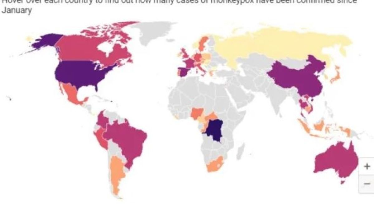 В кои държави вече има случаи на маймунска шарка КАРТИ