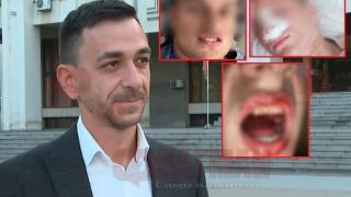 Прокуратурата с нови разкрития за жестокия побой в Айтос! 