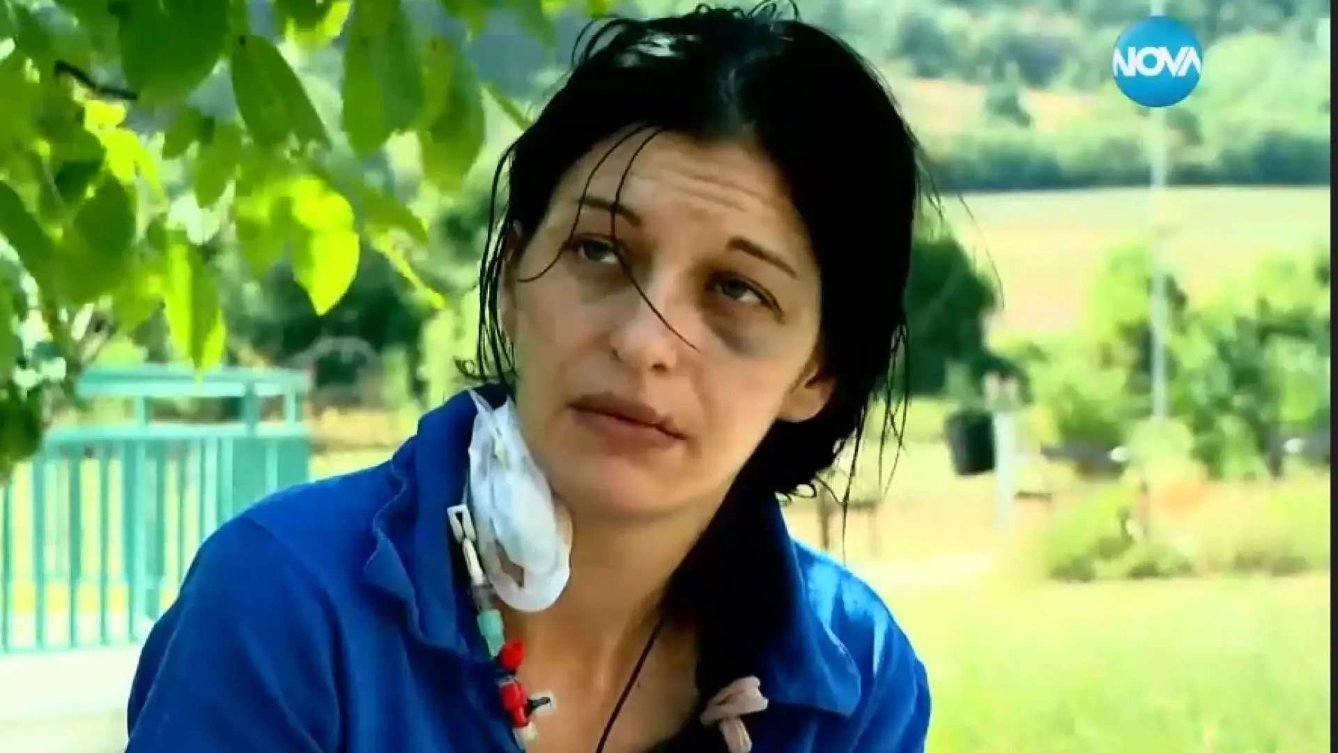 Почти убийство в Челопеч: Жена е с изваден яйчник, две счупени ръце и... ВИДЕО 18+