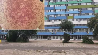 Случай като за филм в наша болница: Пациент цял живот ще е благодарен на лекарите