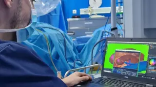 Иновативен хирургичен метод с добавена реалност и изкуствен интелект прилагат уролозите в “Софиямед”