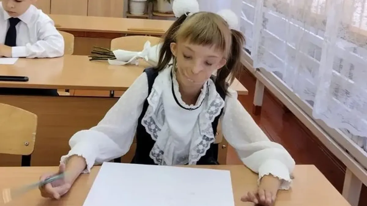Семейството й се отказа, не може да я гледа: Всички се чудят как изглежда „момичето с половин лице“ СНИМКИ 18+