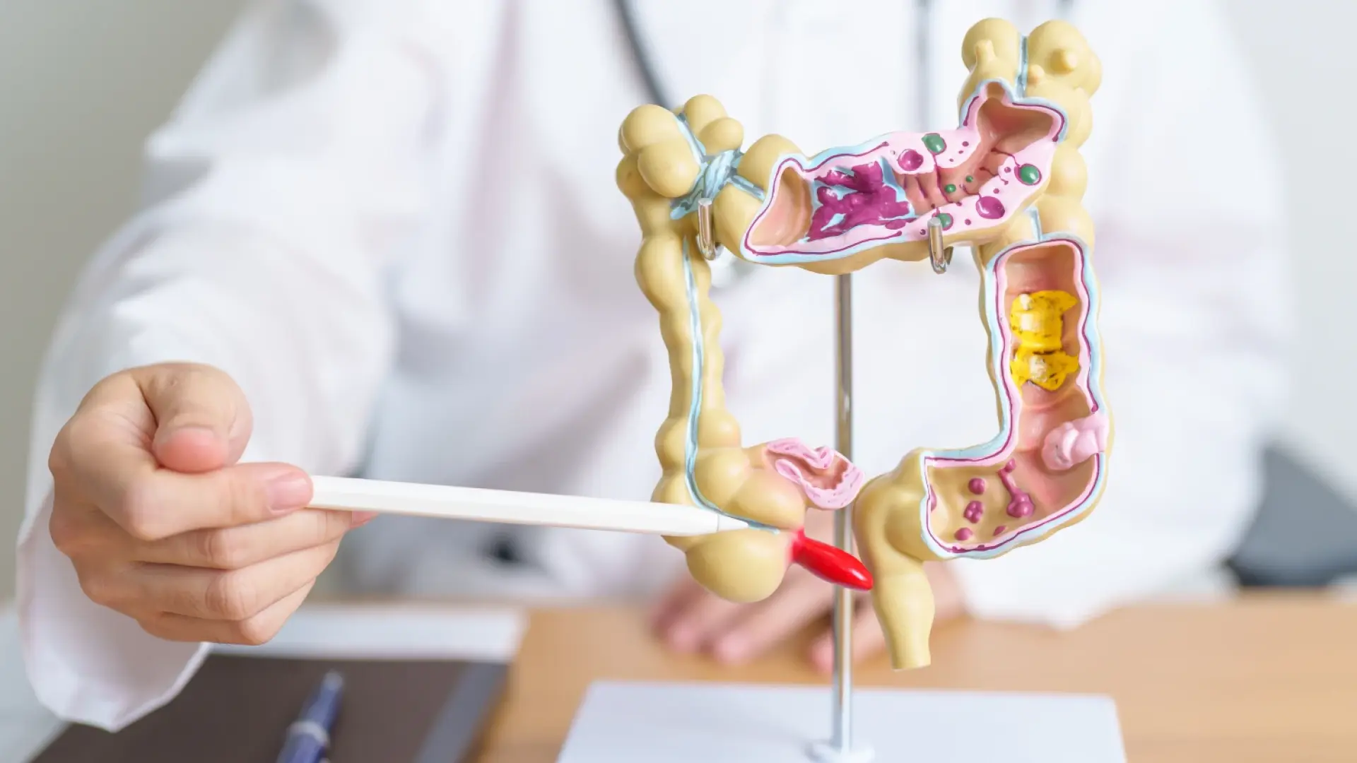 Внимание! Тази храна може да възпали апендицита ни