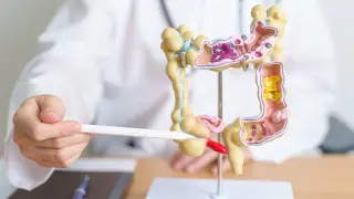 Внимание! Тази храна може да възпали апендицита ни