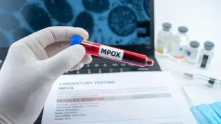 Лошо! Засякоха първи случай на страшно заболяване в страна, на един хвърлей от България