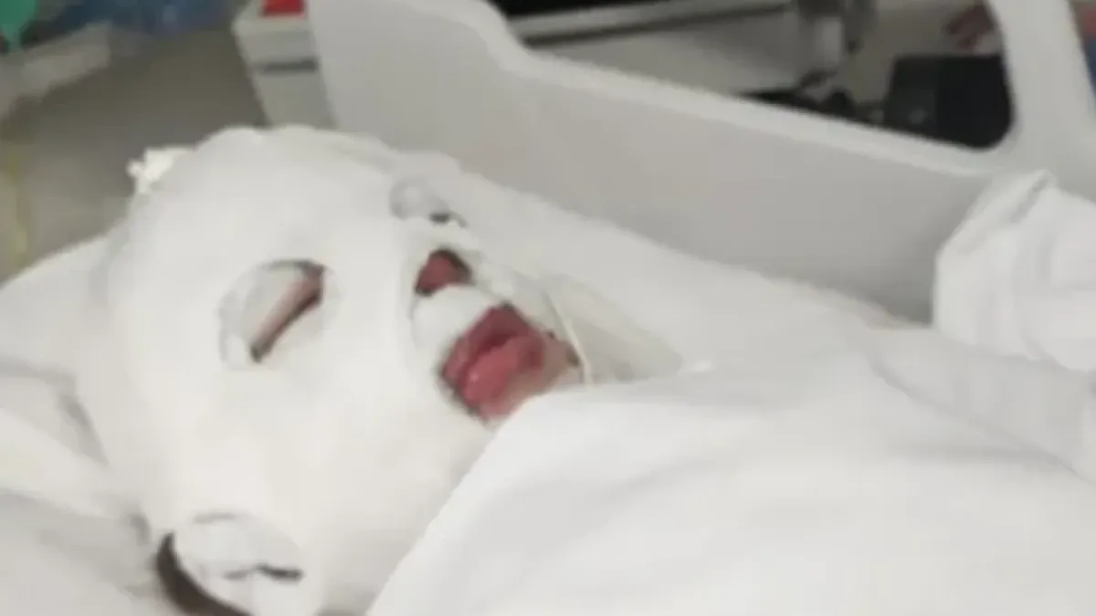 Кожата ѝ падаше: 8-г. Дани започна да гори жива, след като облече пуловер от китайски сайт СНИМКИ 18+