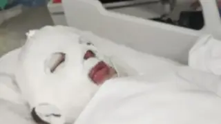 Кожата ѝ падаше: 8-г. Дани започна да гори жива, след като облече пуловер от китайски сайт СНИМКИ 18+