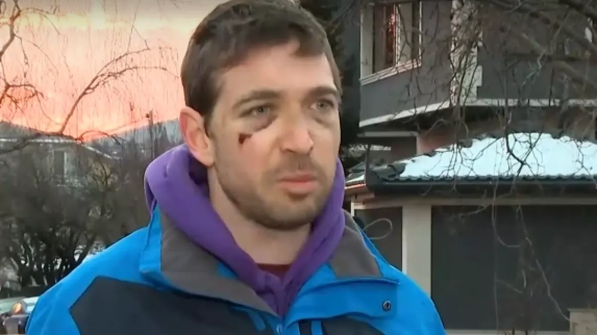 След забележка на пътя: Смляха от бой мъж пред бременната му съпруга в "Драгалевци" ВИДЕО