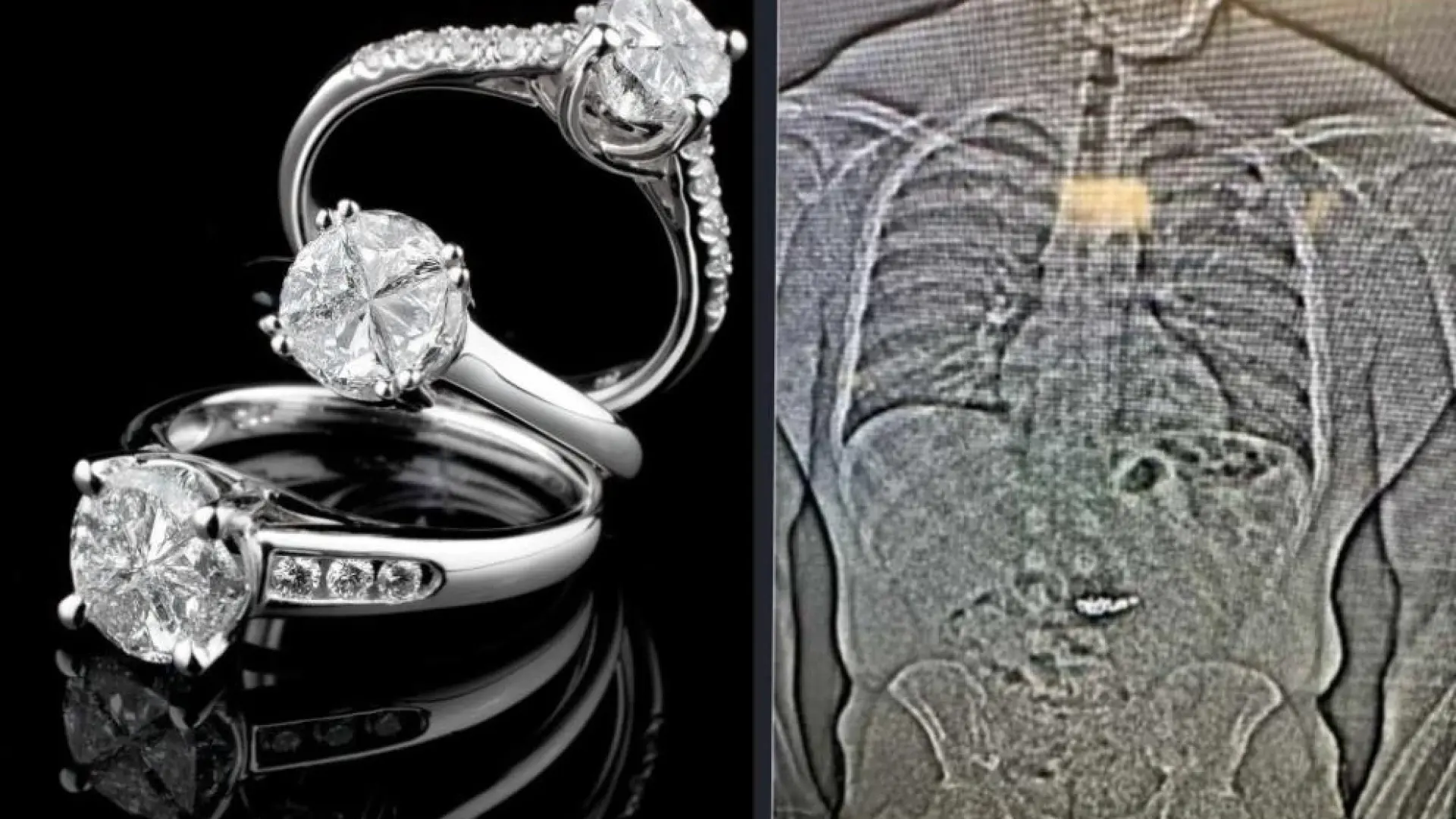 Не е за вярване къде мъж скри откраднати от него диаманти за 1 млн. долара 