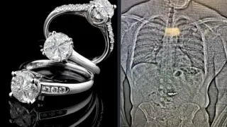 Не е за вярване къде мъж скри откраднати от него диаманти за 1 млн. долара 