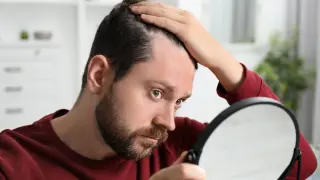 Как да изберем най-добрата клиника за трансплантация на коса в Турция?