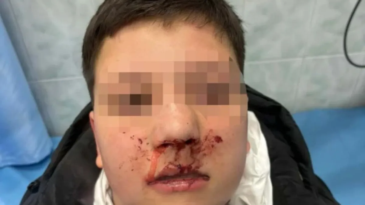 Невиждана жестокост! Клаха с ножове и помляха с чукове 12-годишен в Бургас ВИДЕО 18+