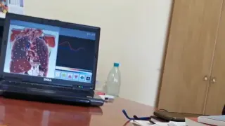 „Имаш тумор в мозъка”: Пишман медици раздават страшни диагнози ВИДЕО