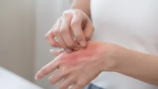 Погледнете кожата си и видите ли това, имате проблем