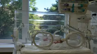 Изключително малко бебе се роди в Пловдив, лекарите се борят за живота му