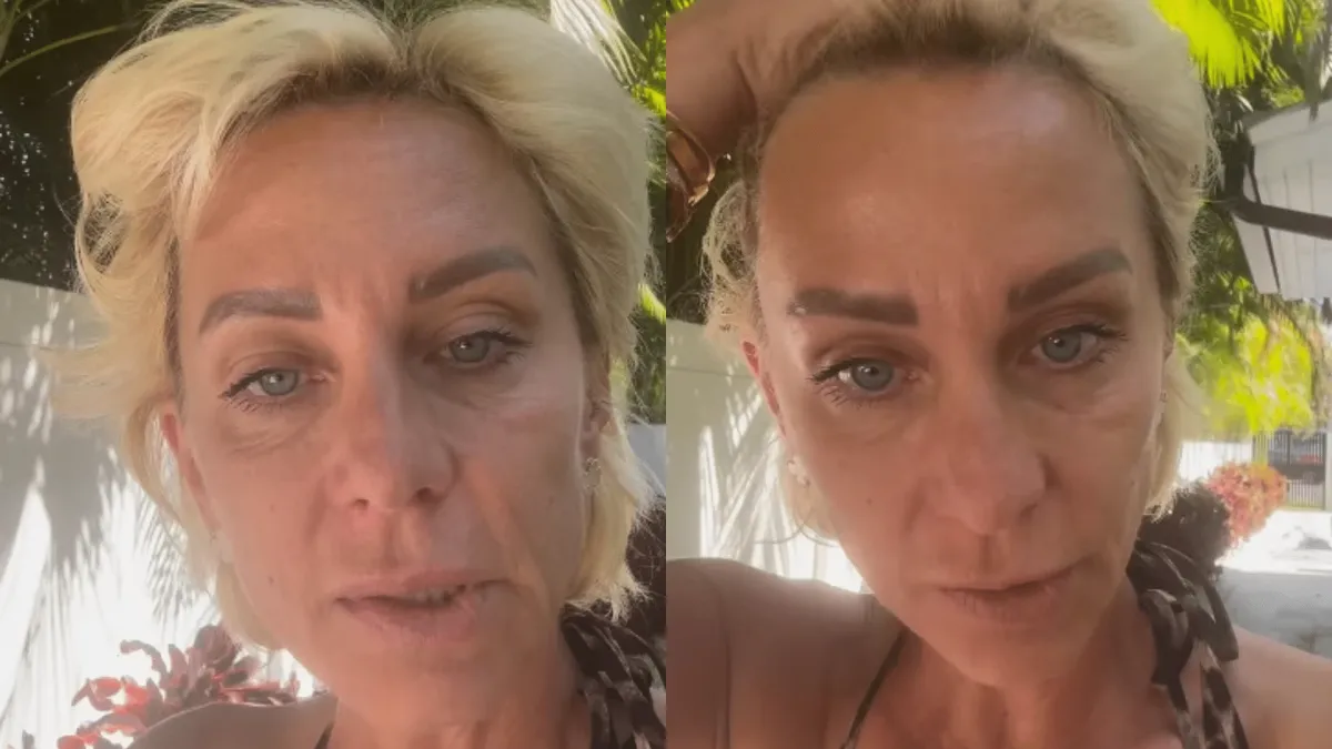 Нана Гладуиш още бори сериозните поражения по лицето си ВИДЕО