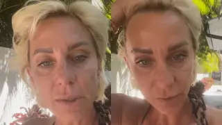Нана Гладуиш още бори сериозните поражения по лицето си ВИДЕО