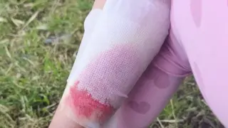 Зъл пес пусна кръв на наше дете