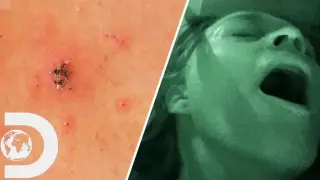 Вадят кърлежи от вагината и пениса на руснаци след секс на площада 18+