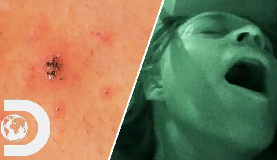 Вадят кърлежи от вагината и пениса на руснаци след секс на площада 18+