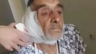 Селският кмет, пребил мъж с лопата, го загази