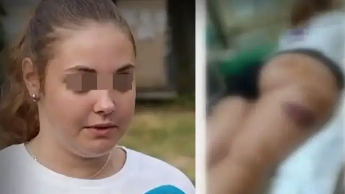 Бездомни кучета наръфаха дете в Асеновград, има и още нападения Видео