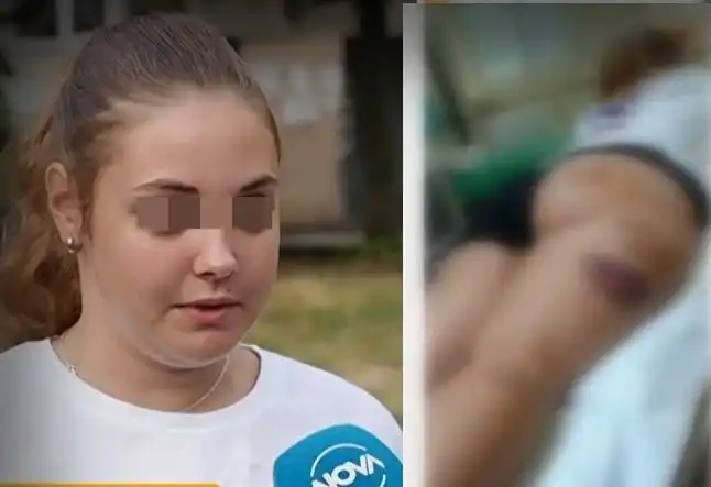 Бездомни кучета наръфаха дете в Асеновград, има и още нападения Видео