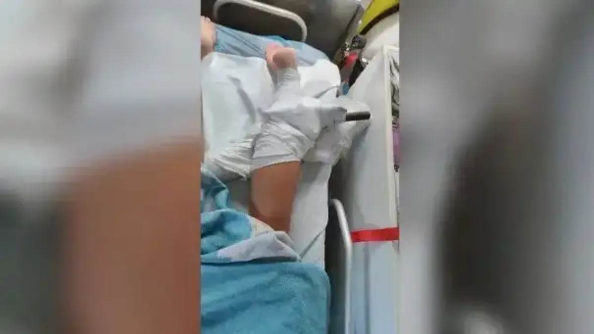 Ужас на плаж в Халкидики: Дръжка от чадър прониза крака на жена