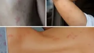 Страшна напаст плъзна из София и големите градове, гадините смучат кръв
