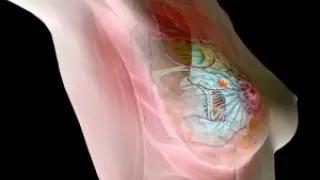 Ново откритие, което ще промени борбата с рака на гърдата