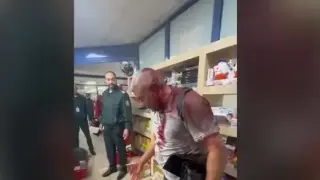 Брутален бой на летището в София, мъж е целият в кръв, главата му е разбита Видео 18+