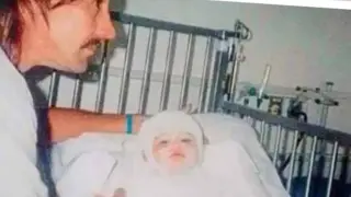 Бях само на 14 месеца, когато изгорях и се наложиха 70 операции, а после разбрах, че майка ми е най-голямото зло Снимки 18+