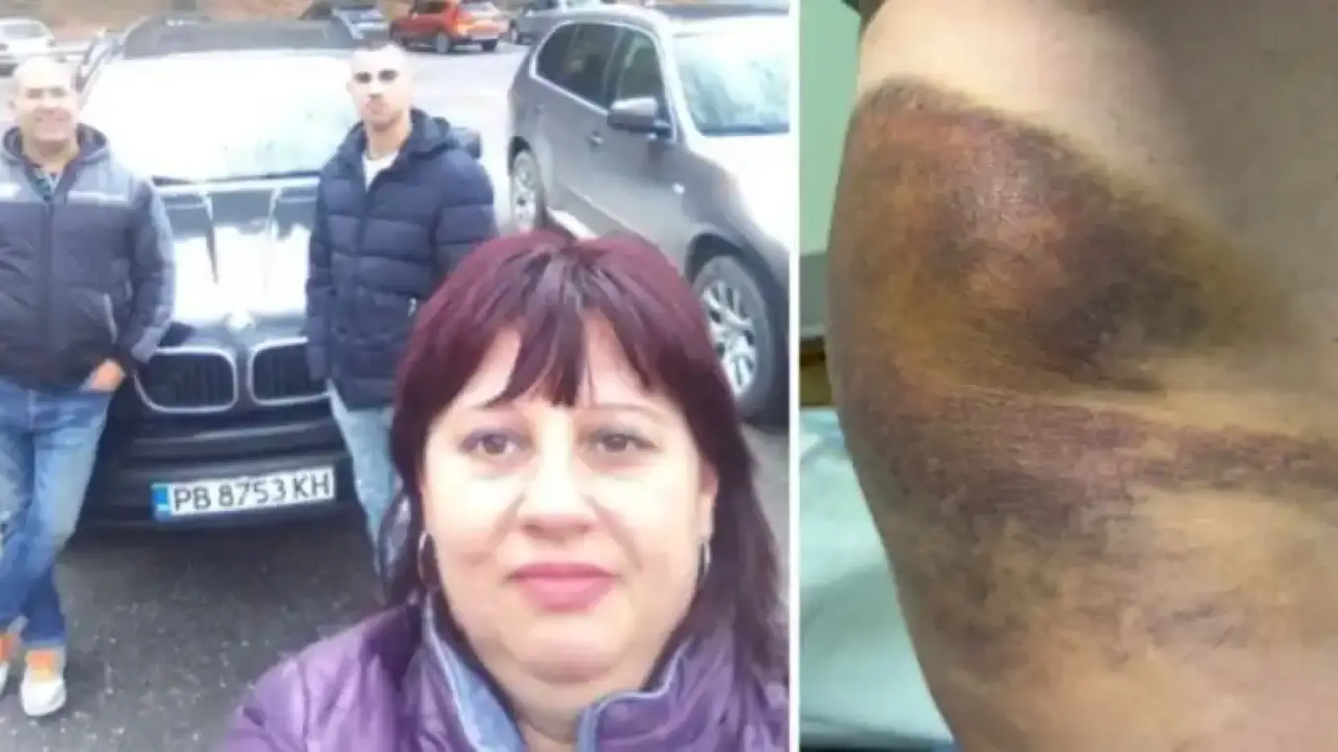 Драма в Цалапица: Бащата на кмета преби тъща му и я изхвърли пред кофите за боклук, в дъното е момиче