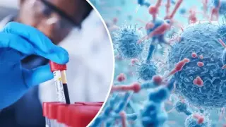 Развъдник на болести: Следващата пандемия започва от Украйна?