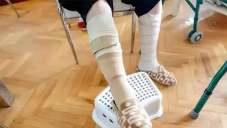 Заплаща ли НЗОК превръзките за хронични рани?