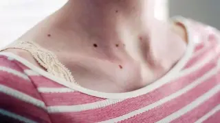 Белязани сте със „Знака на Съдбата“, ако имате това по тялото си