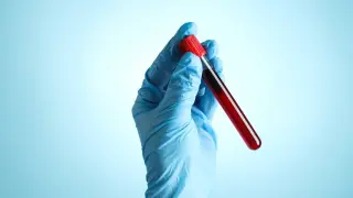 Това е основната причина за инфаркти в напреднала възраст, ето какво ще ви предпази