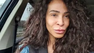 Ужас: Присадиха пръст на Маги Сидерова след неприятен инцидент Снимки