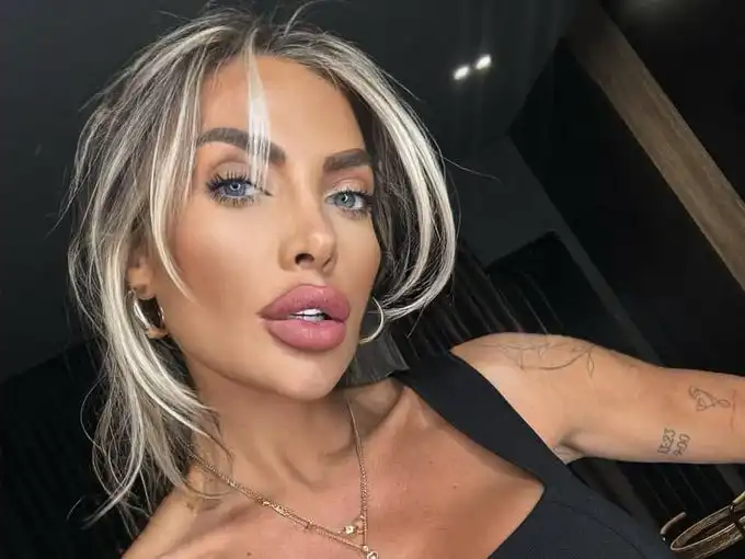 Златка Райкова проговори пред БЛИЦ за секс скандала с пластичния хирург