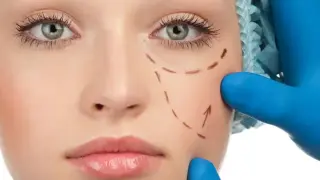 Скритите рискове на естетичната хирургия, за които рядко се говори