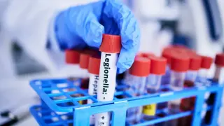Проф. Кантарджиев за легионерската болест, взела първа жертва в България: Температурата може да доведе до гърч