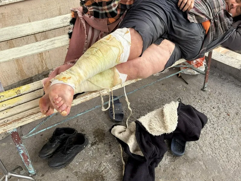 Бездомен мъж с тежки рани с червеи бедства 2 дни пред болницата във Враца