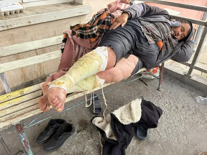 Бездомен мъж с тежки рани с червеи бедства 2 дни пред болницата във Враца